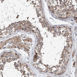 CEP85L Antibody, Novus Biologicals 0.1mL; Unlabeled:Antibodies, Polyclonal